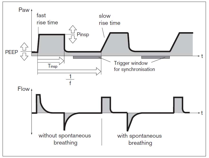 Bipap Vs Cpap. Anwelcome to vent, share your highssince Elevated co levels 